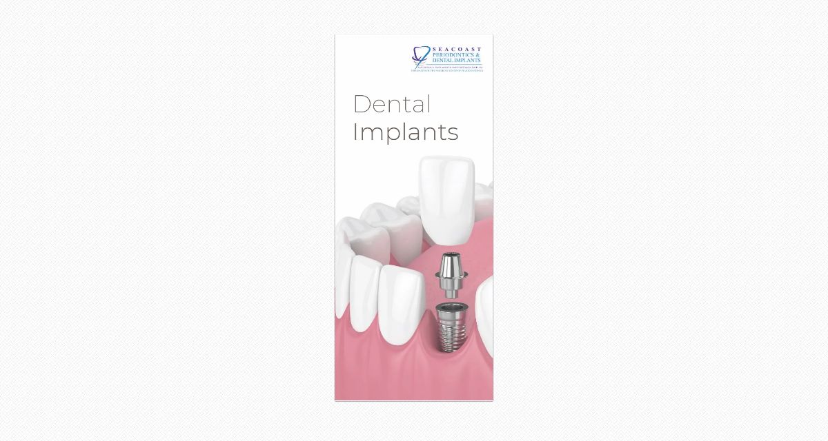 Dental Implants Brochure