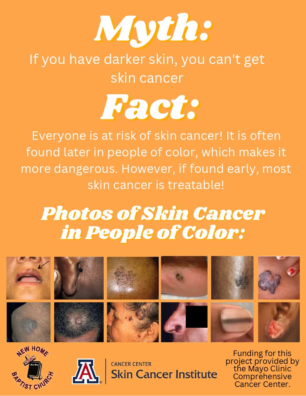Skin Cancer In People of Color