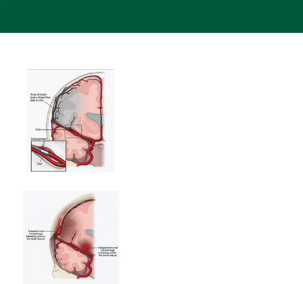 TRMC Stroke Booklet